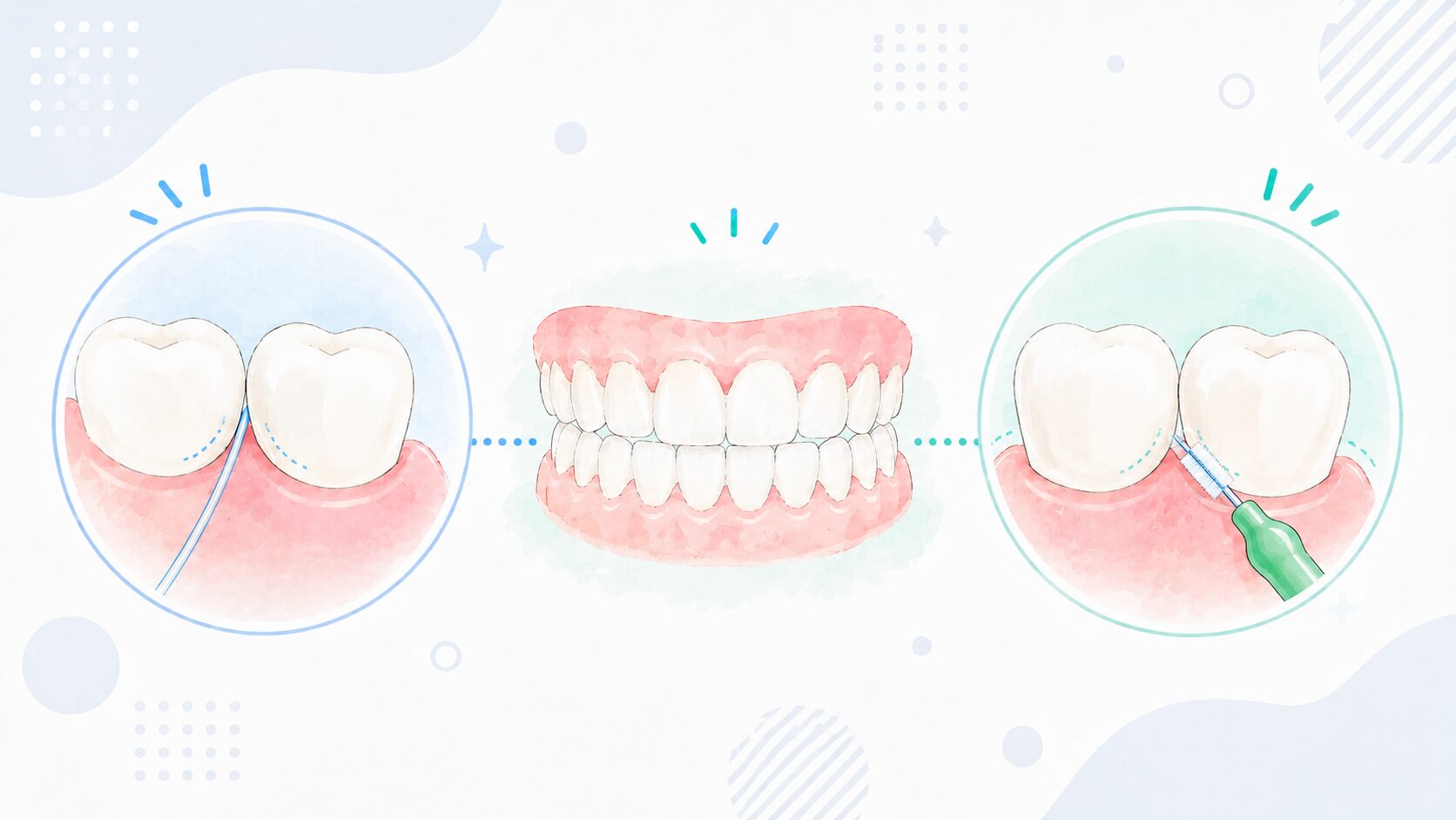 フロスと歯間ブラシの得意な場所を比較したイラスト