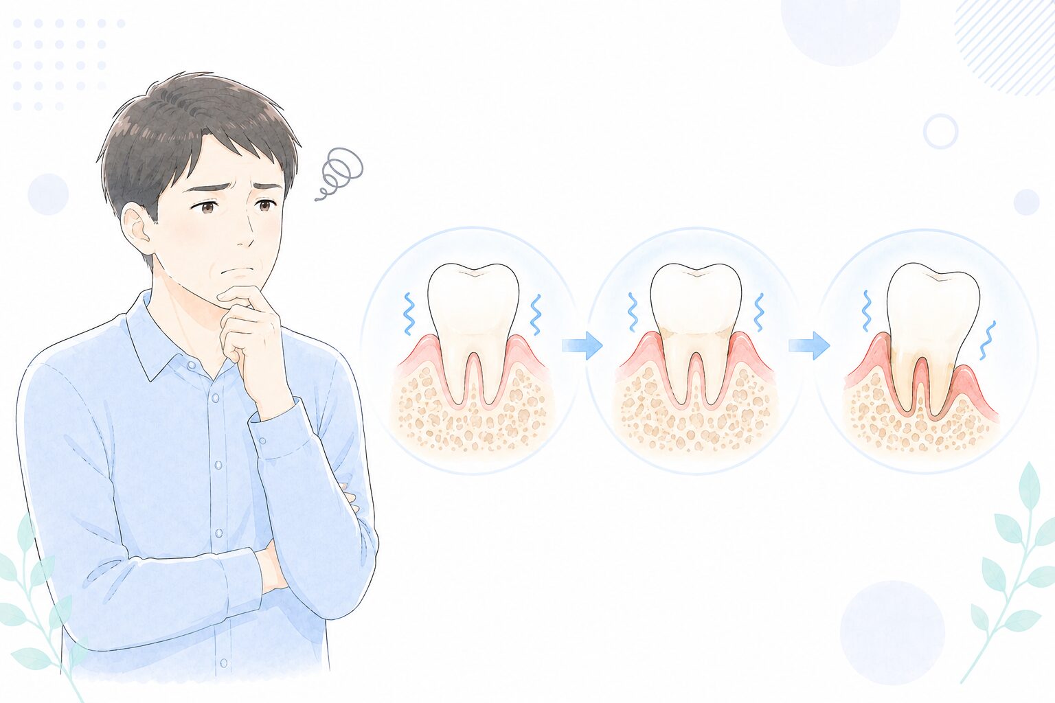 歯周病で歯を支える骨が溶けて歯がぐらつく様子のイラスト