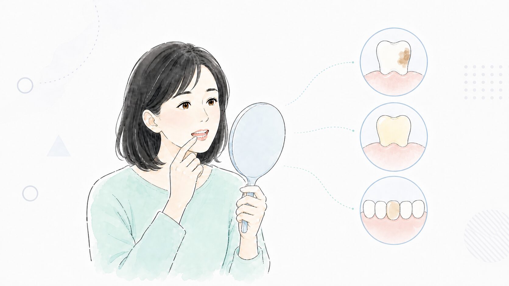 手鏡で歯の色をセルフチェックする女性と黄ばみ3タイプのイラスト