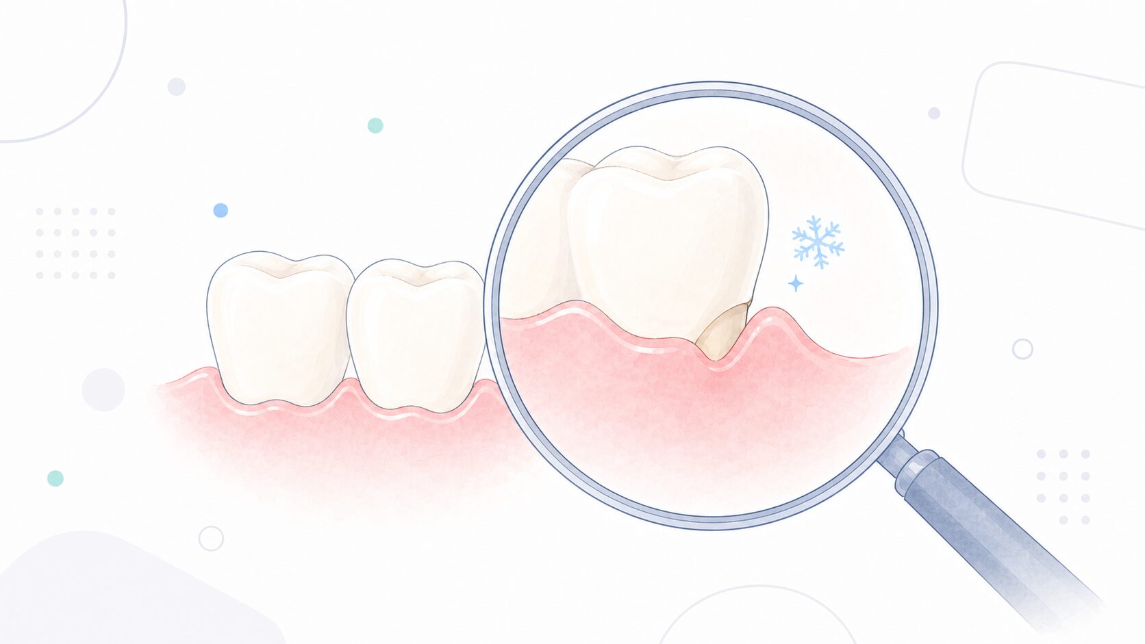 露出した歯根がしみるようすを虫眼鏡で示したイラスト