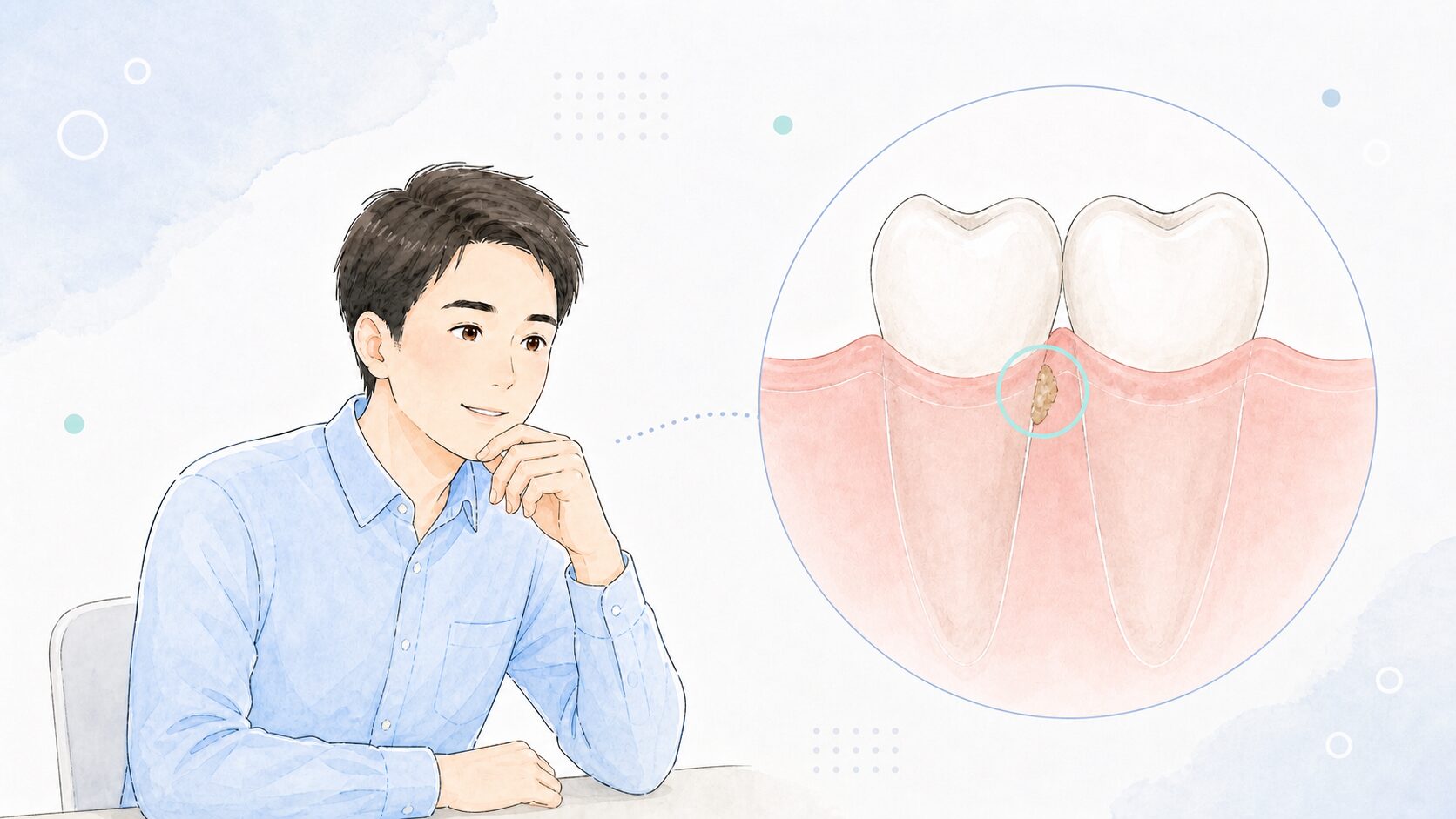 歯科医院で説明を受ける男性と、歯ぐきの中の歯石のイラスト